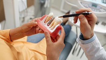 Patient holding model of dental implant in treatment chair